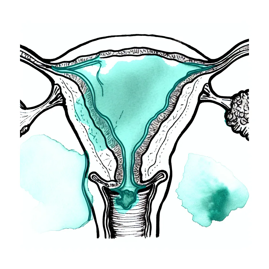 خونریزی سیاه در اوایل بارداری و احتمال هماتوم