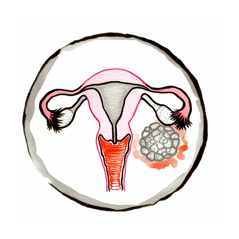 خونریزی و درد بعد از کورتاژ تشخیصی؛ طبیعی یا خطرناک؟