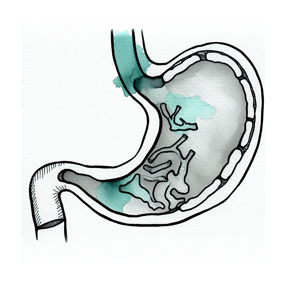 ناراحتی معده - دیر هضم شدن غذا، احساس ورم داشتن