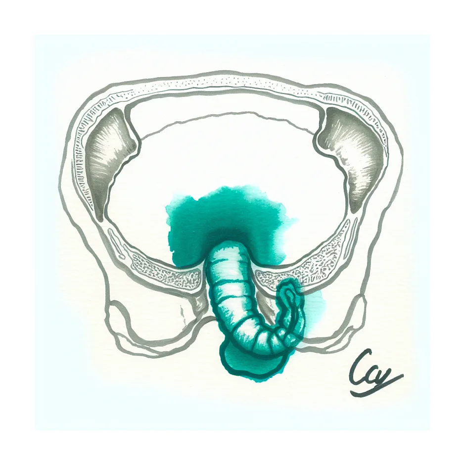 گیر کردن خیار در مقعد هنگام رابطه چه باید کرد؟