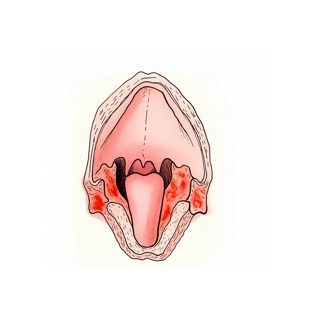 گلودرد طولانی و خشکی گلو؛ آیا روزه گرفتن مجاز است؟