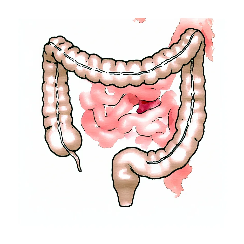 اسهال بعد از شربت آموکسی‌کلاو در کودک