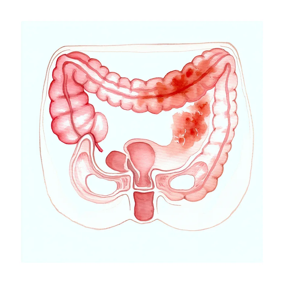 آیا رابطه مقعدی بدون کاندوم ضرر دارد؟