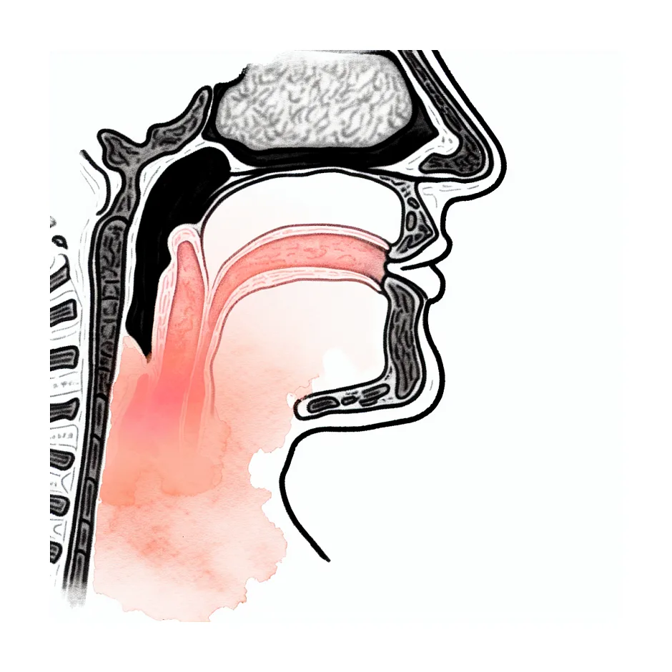 سوزش مداوم گلو — علل و راهکار فوری
