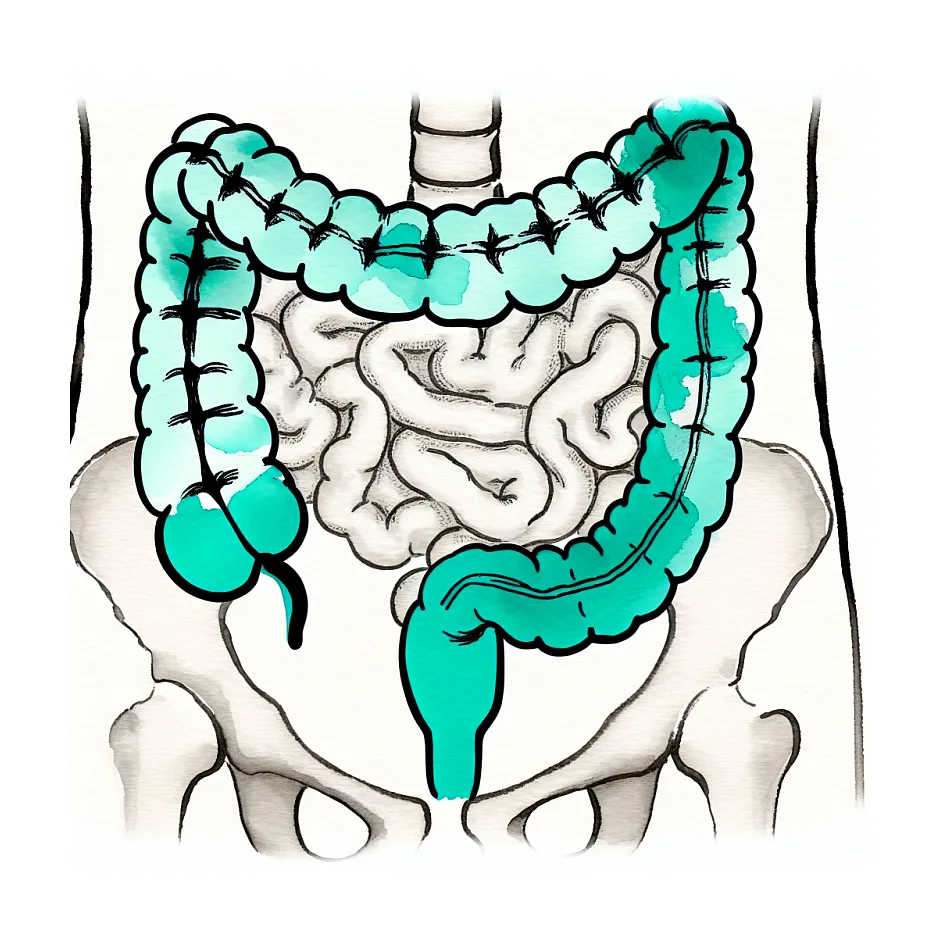 تفاوت بیماری IBD و IBS و علائم آنها