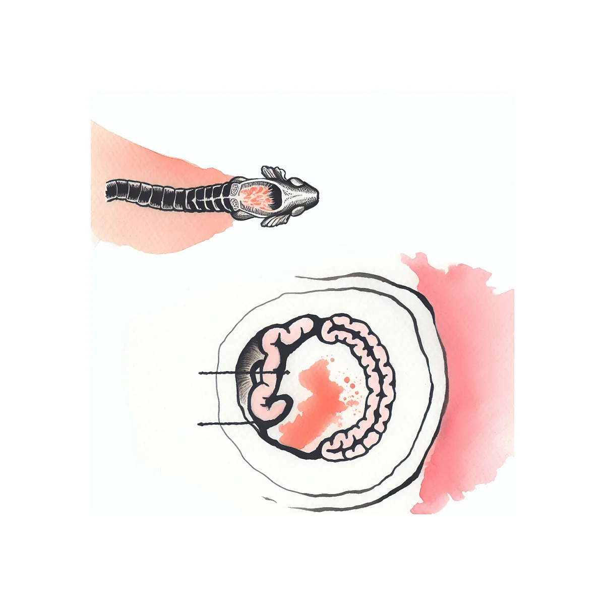 علت نبض زدن کنار ناف راست شکم در قاعدگی