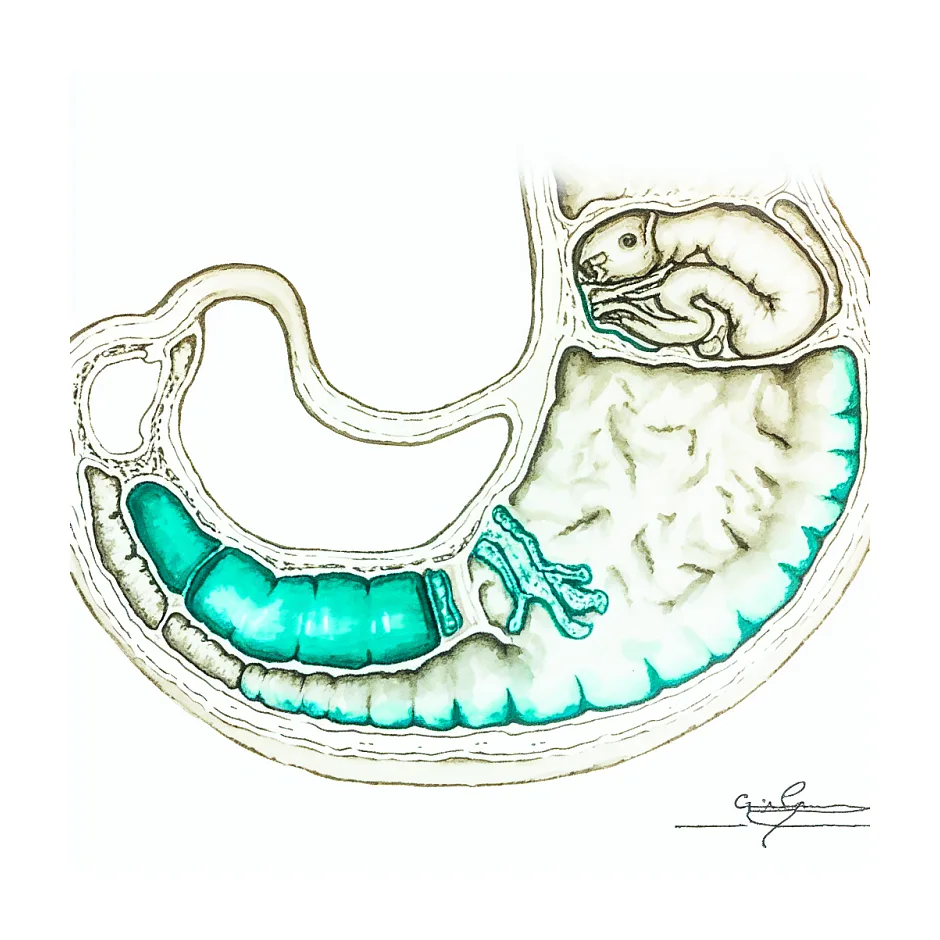 عوارض امپرازول طولانی‌مدت در نوزاد ۵ ماهه