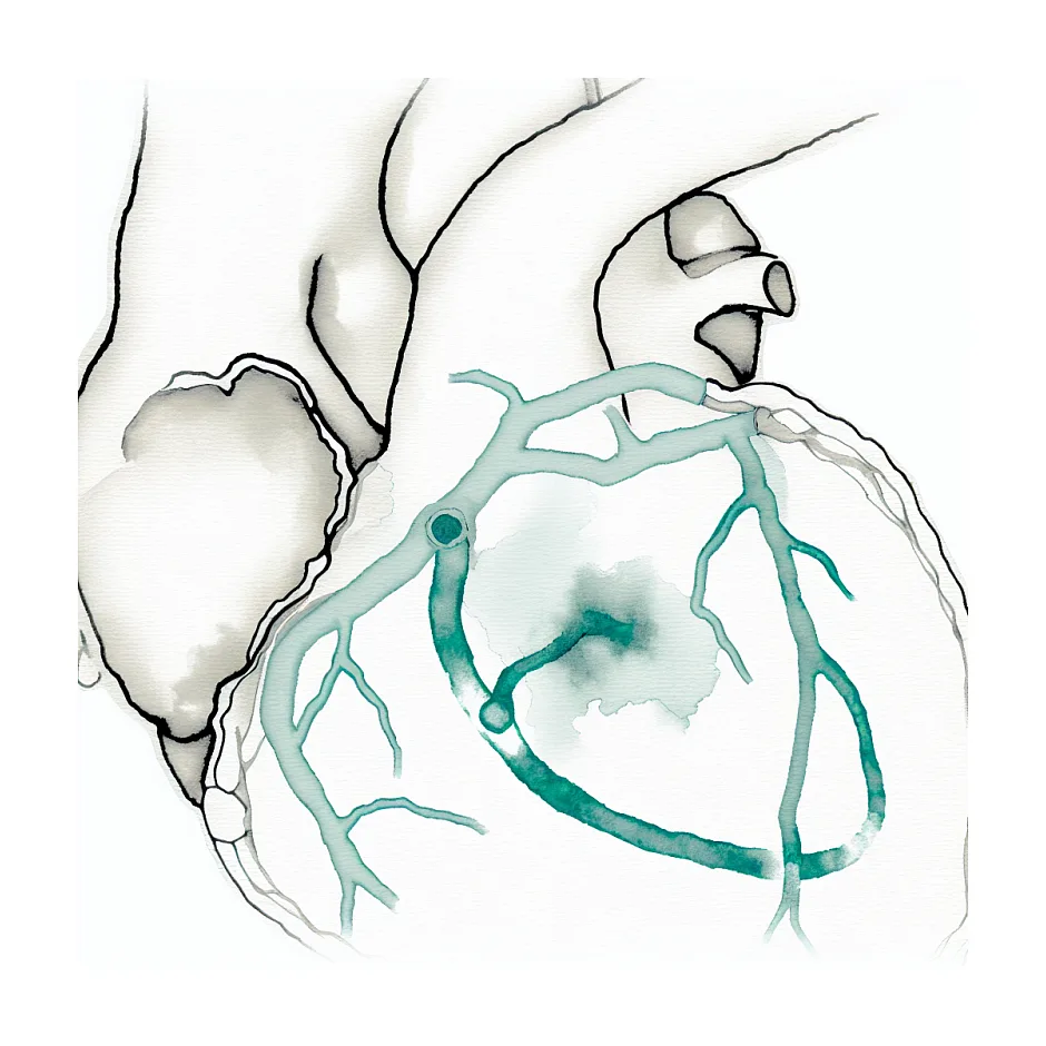 علت ضعف و بی‌حالی بعد از آنژیوپلاستی قلب