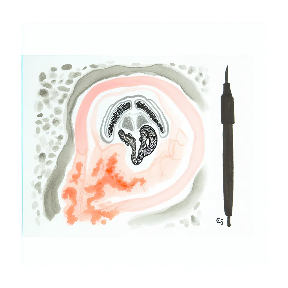 درمان گشادی و تنگ شدن مقعد بعد از رابطه