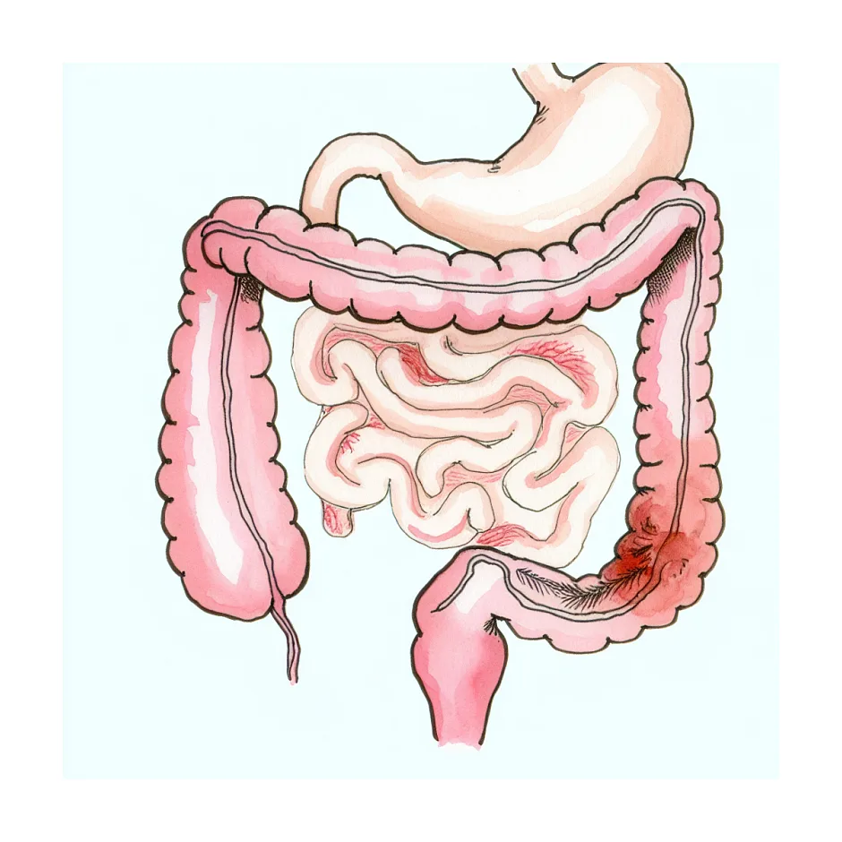علت تیر کشیدن و سوزش روده و شکم در خانم‌ها