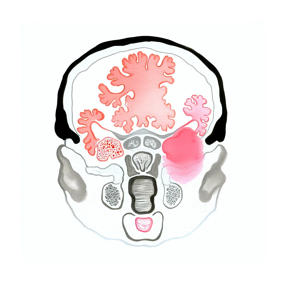 علت عرق کردن و داغ شدن هنگام رابطه جنسی