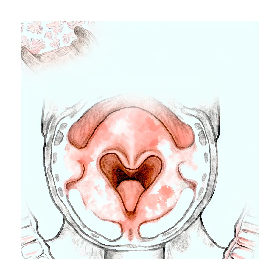 سرفه و گلو درد نوزاد یک ماه و نیمه؛ چه کنیم؟