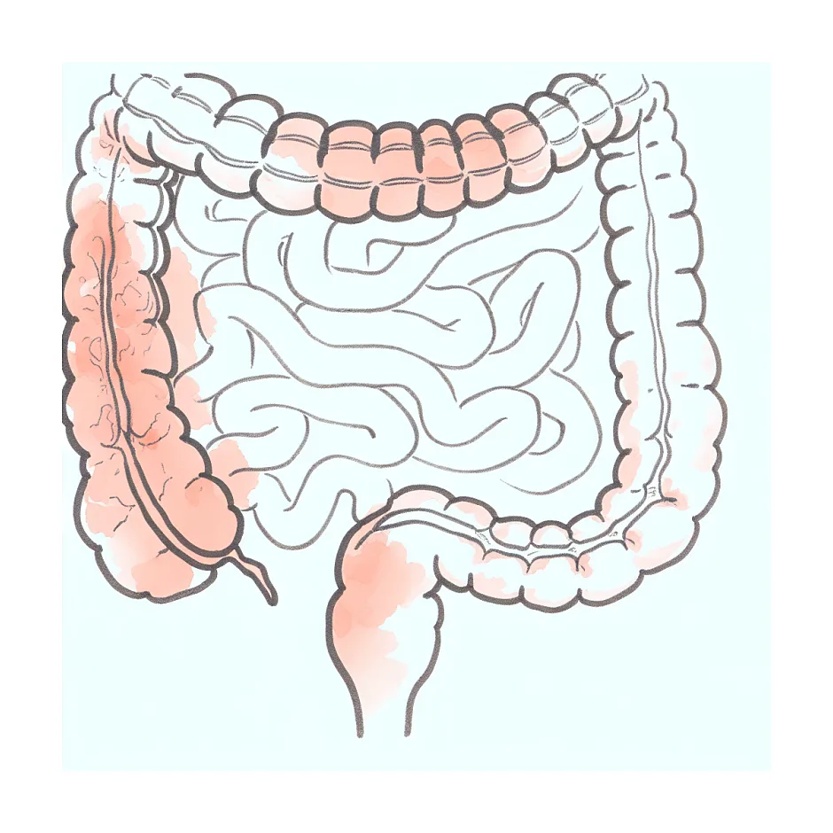 تأثیر شیر خشک نان بر یبوست نوزادان