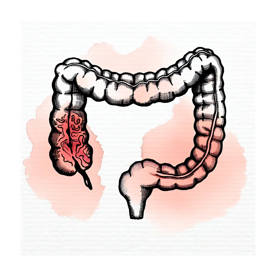 علت مخاط خونی در مدفوع با کولونوسکوپی نرمال