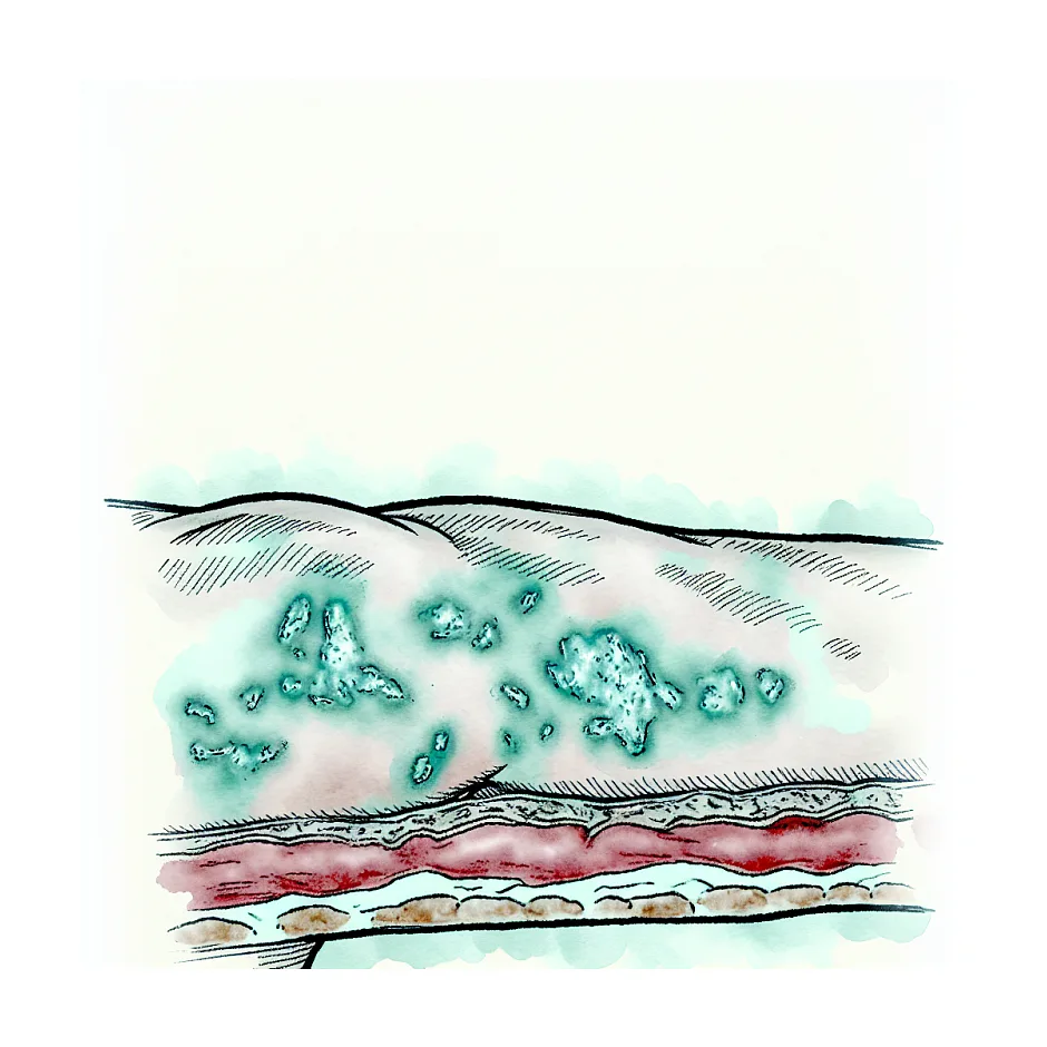 حساسیت بدنی ناشی از مصرف قرص گین اپ