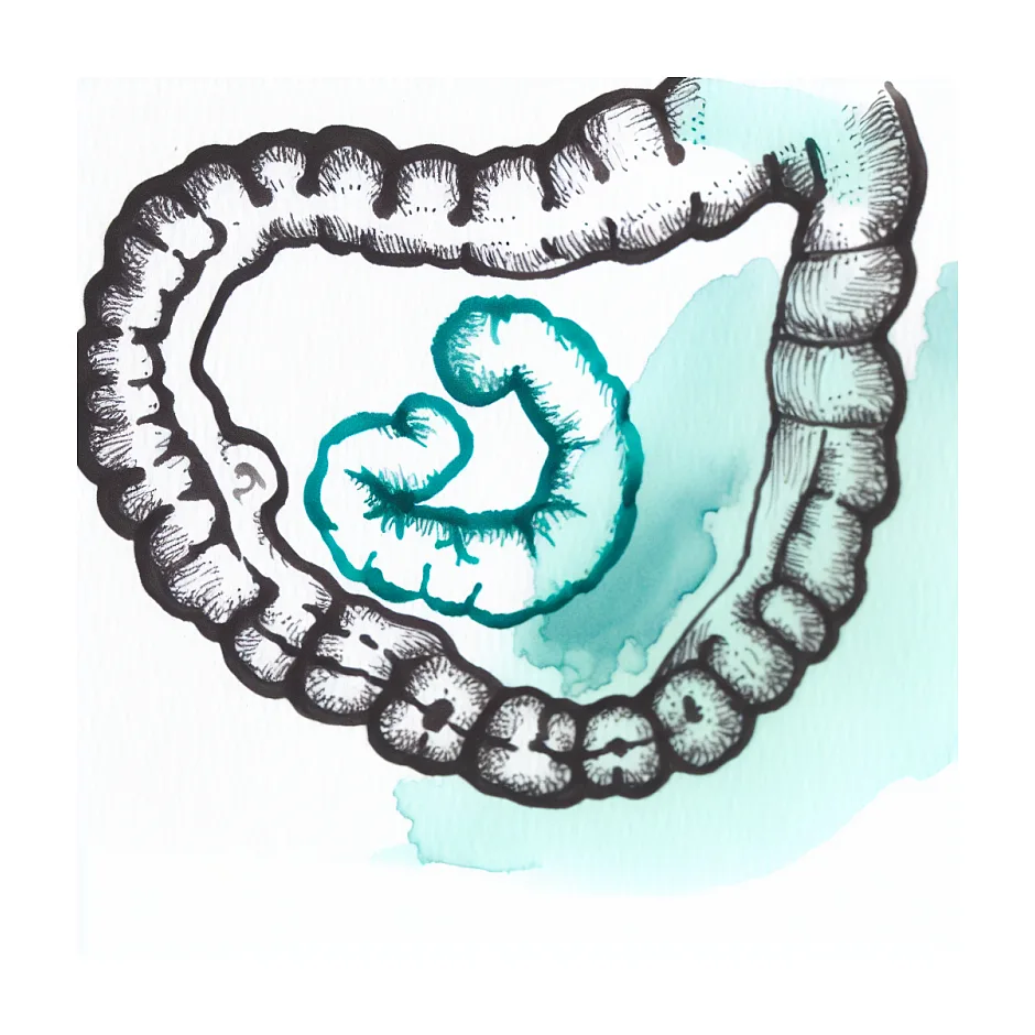 شیرخشک نان AR و یبوست و نفخ نوزاد ۴۷ روزه