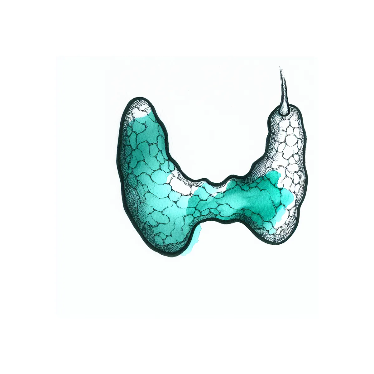 روزه گرفتن در کم کاری و گره‌های تیروئید