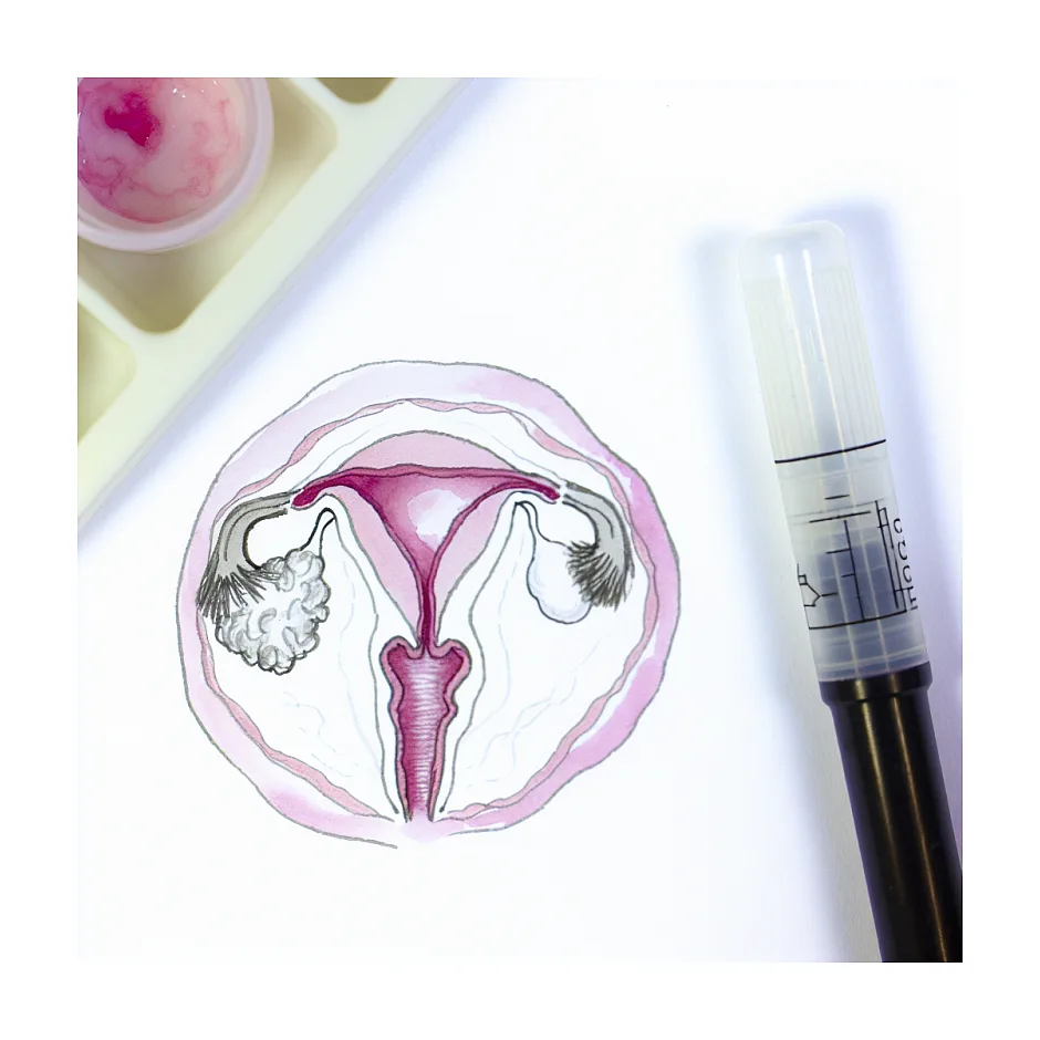 قرص ماریانا برای عفونت و قارچ واژن