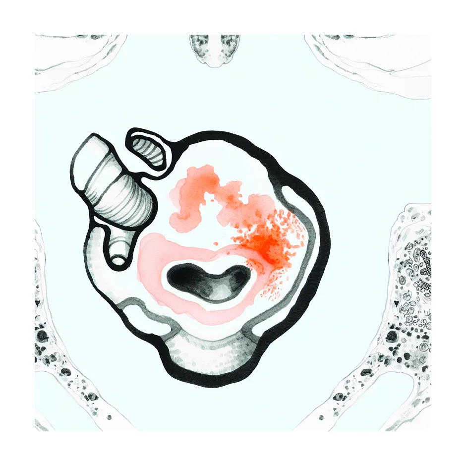 دوز مناسب کوآموکسی‌کلاو در سینوزیت حاد