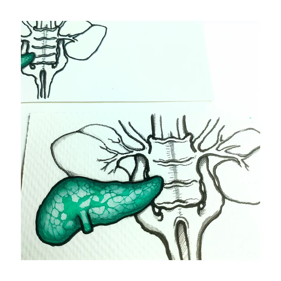 درد زیر دنده چپ با وجود کیست پانکراس؛ چه کنم؟