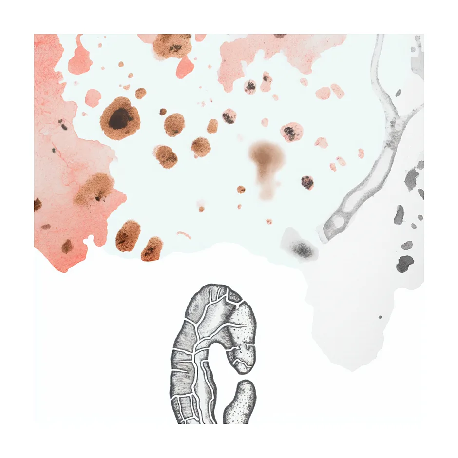 علت و درمان لکه‌ های قهوه‌ای روی ساق پا