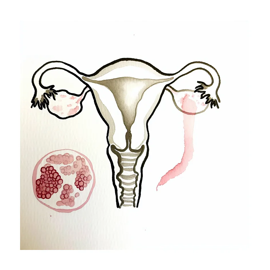 چند روز بعد از رابطه بارداری و امکان سقط با دارو