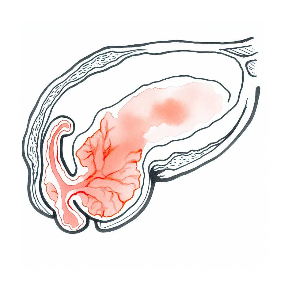 جلوگیری از خروج منی و ارتباط آن با التهاب پروستات