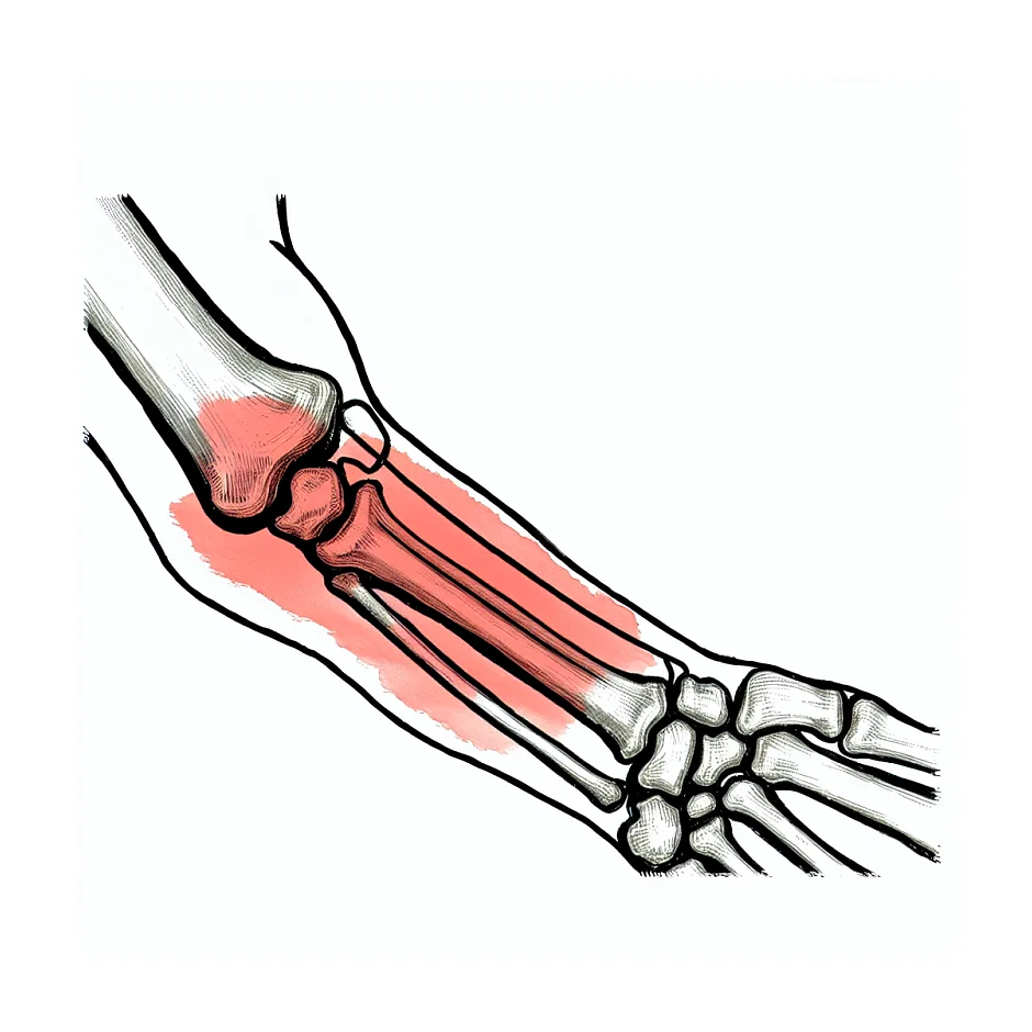 علت درد روی پلاتین بازو و امکان خارج کردن آن