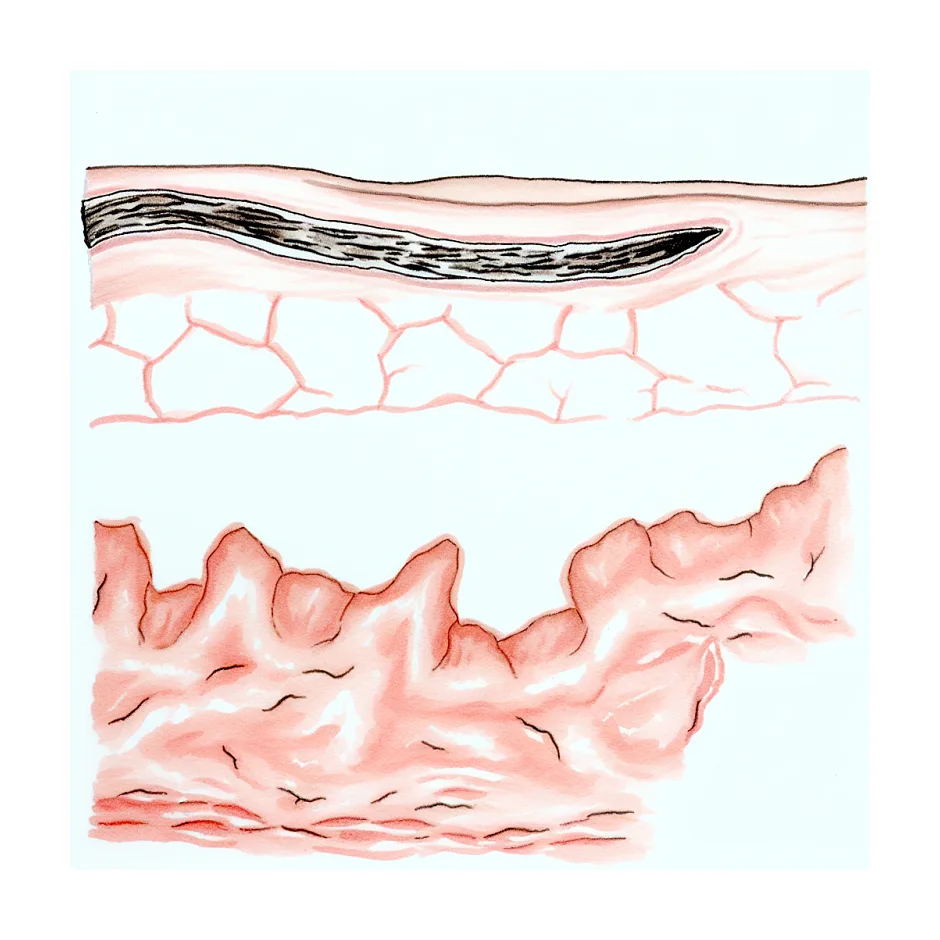 آیا جای ناخن روی صورت برطرف می‌شود؟