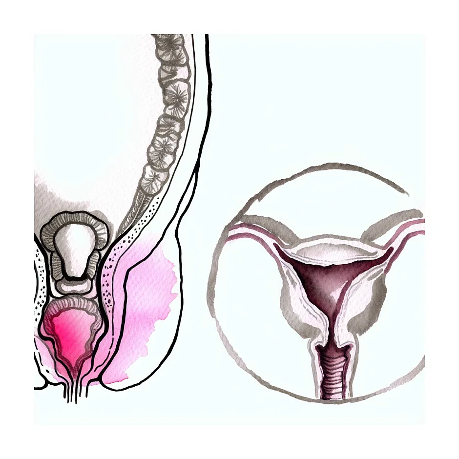 درد زیر شکم بعد از برداشتن پرده بکارت