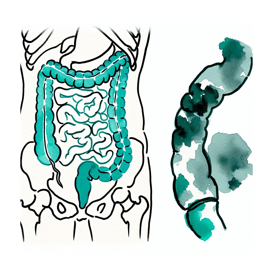 علت درد شکم و تنگی نفس بعد از عمل روده