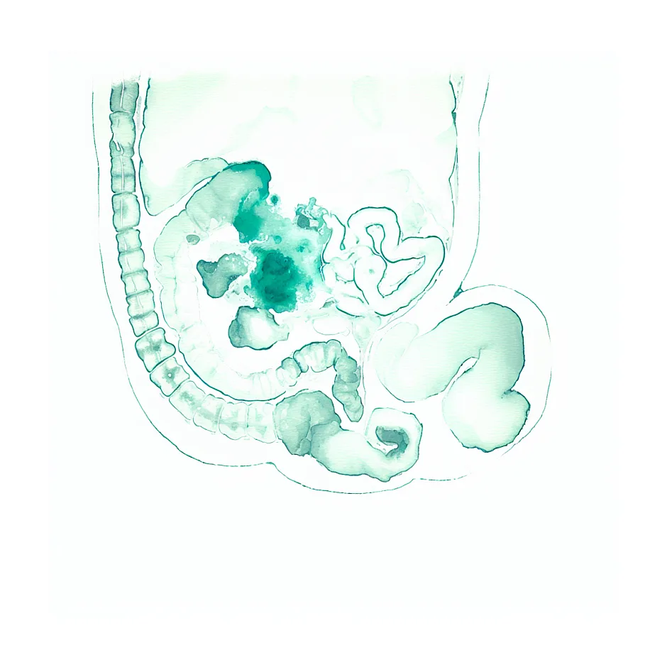 دل‌درد و بوی بد مدفوع با شیر خشک ببلاک کامفورت