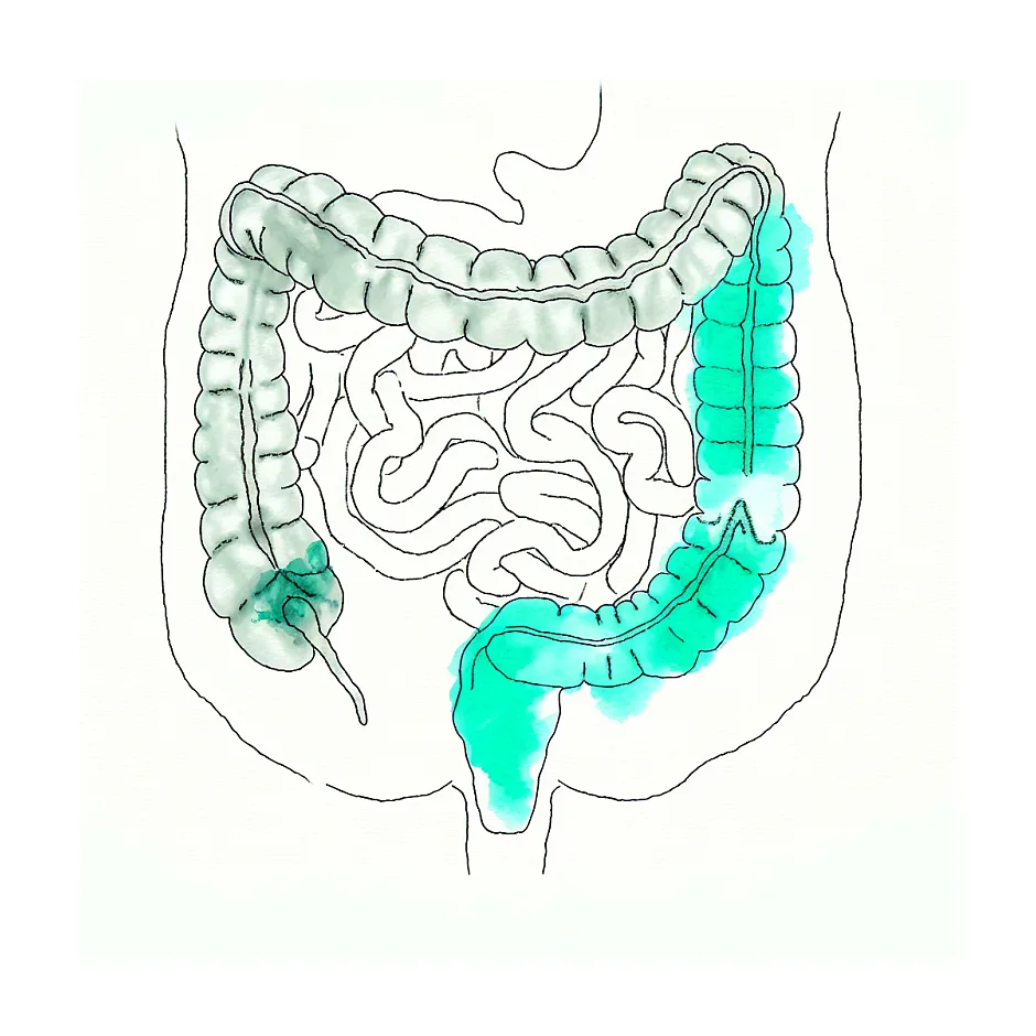 علت پیچ و تاب نوزاد در خواب و راهکارها
