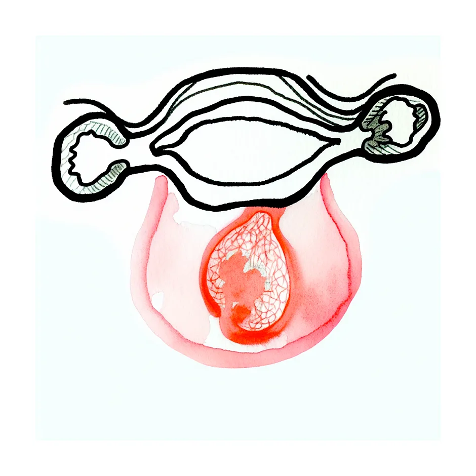 فولیکول زیر ۱۰ میلی‌متر در سونوگرافی یعنی چه؟