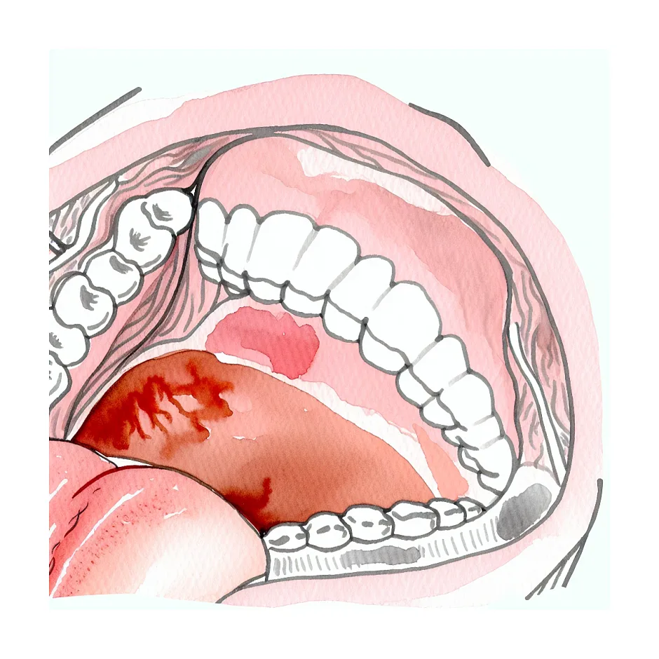 آیا تلخی دهان از علائم اولیه بارداری است؟