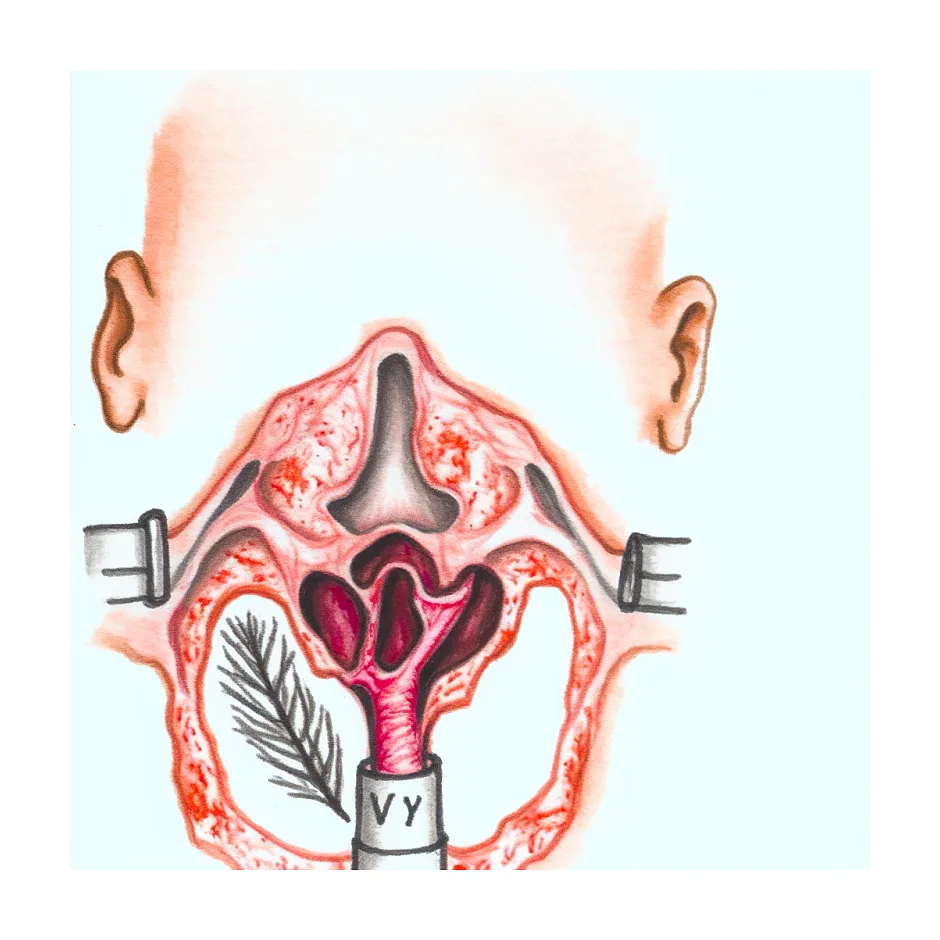 علت صدای خرخر گلوی نوزاد چهارماهه