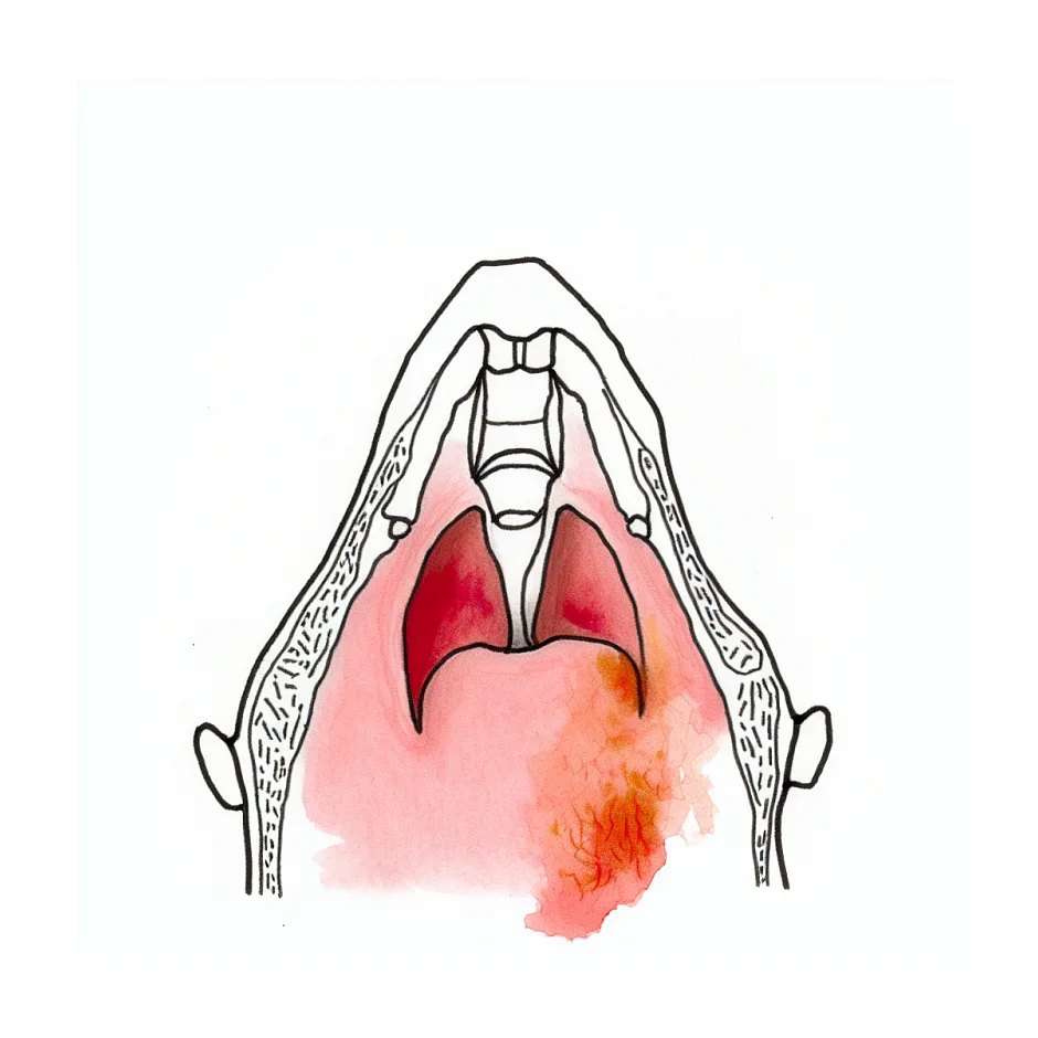 دوز مناسب آموکسی‌کلاو و پنی‌سیلین در کودک ۱۳ ساله