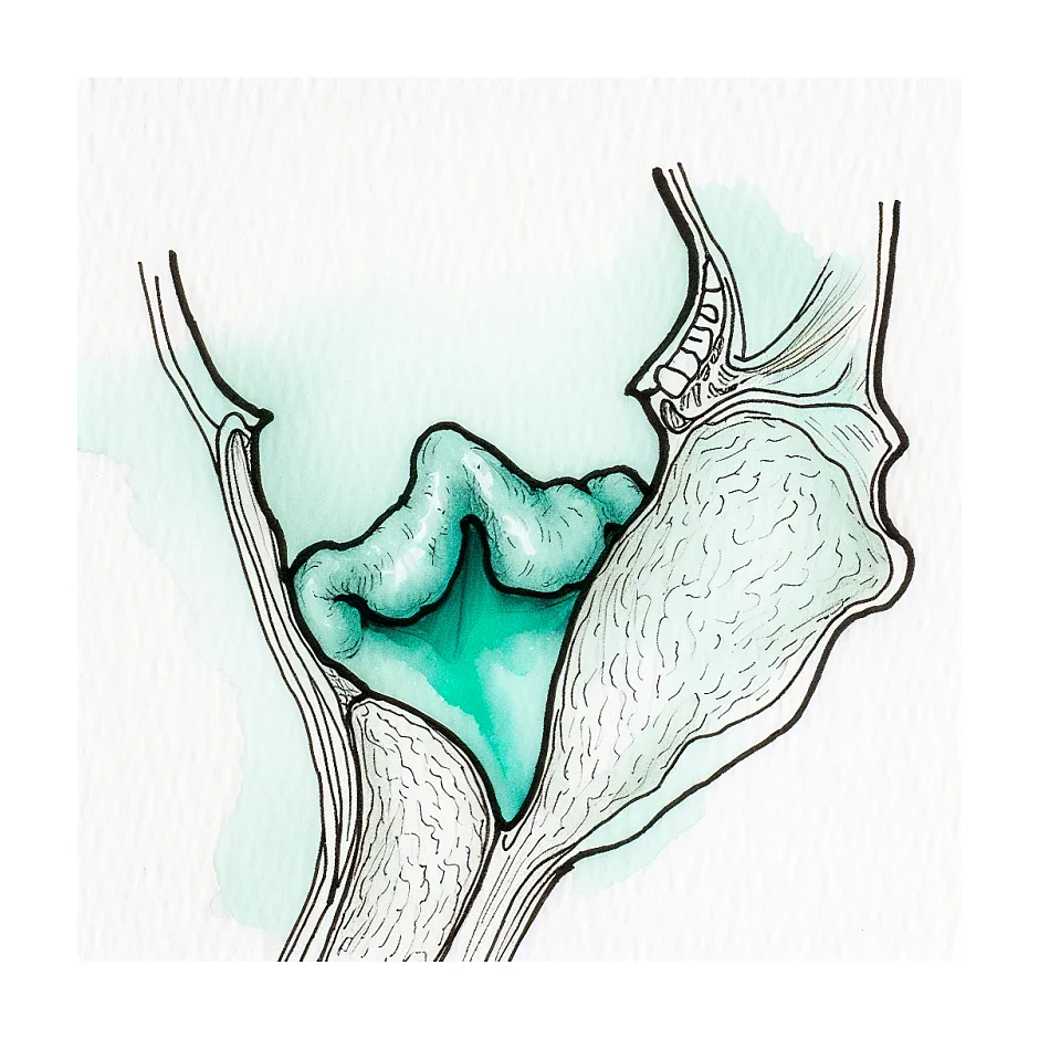 هزینه عمل لوزه در بیمارستان دولتی و خصوصی