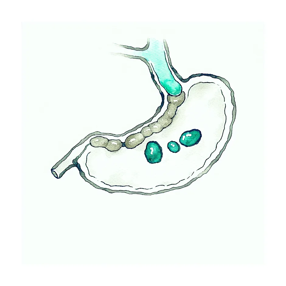 آیا بعد از برداشتن کیسه صفرا (کوله‌سیستکتومی) باز هم سنگ مجاری صفراوی تشکیل می‌شود؟ علت درد و راه تشخیص