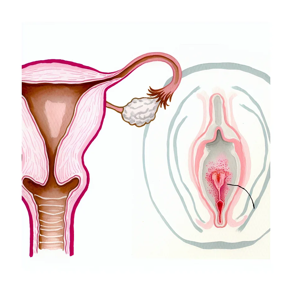 زمان شستشو بعد از کرم واژینال کلوتریمازول