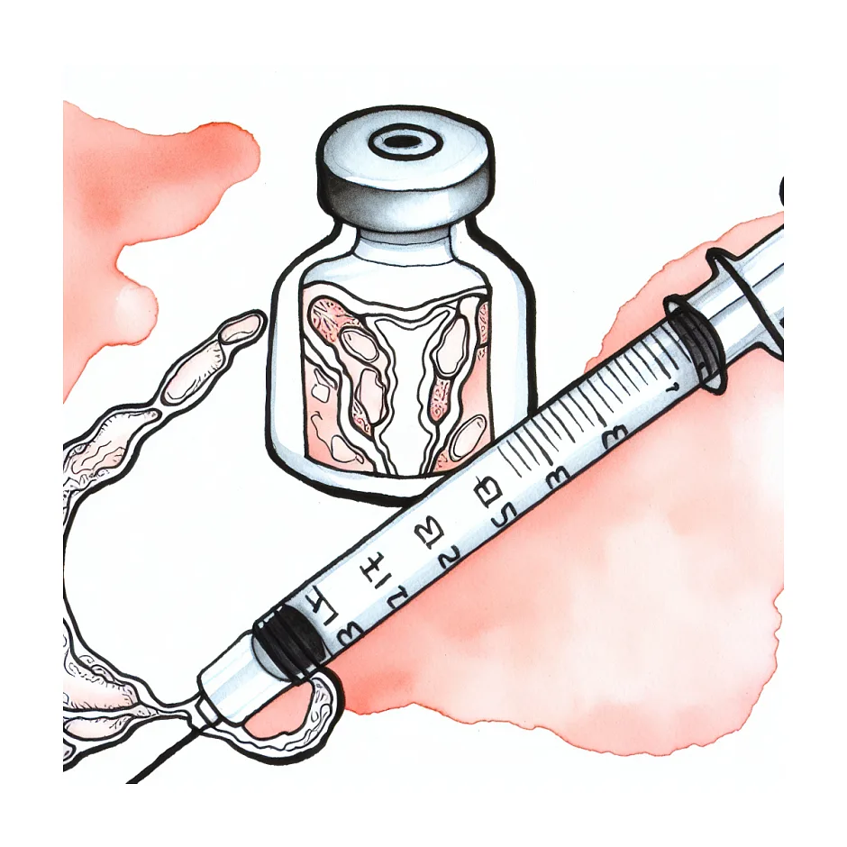 راهنمای مصرف و تهیه آمپول پروژسترون