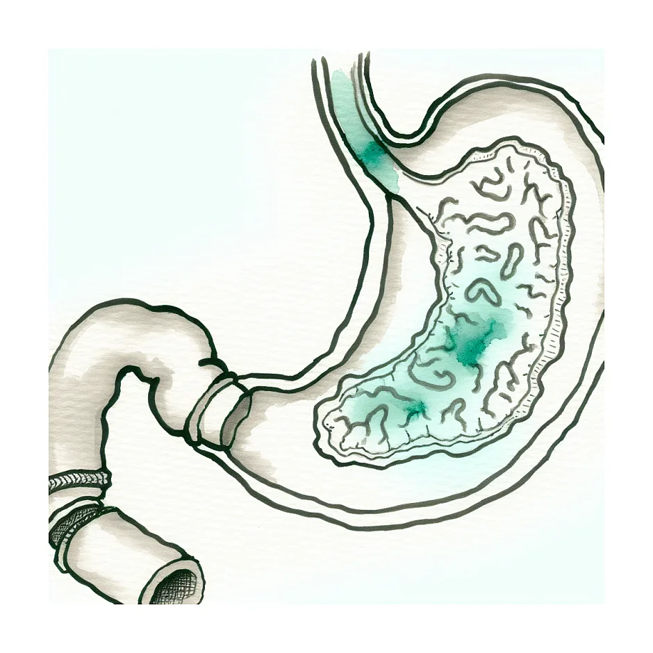 تفاوت رابپرازول و امپرازول؛ کدام بهتر است؟