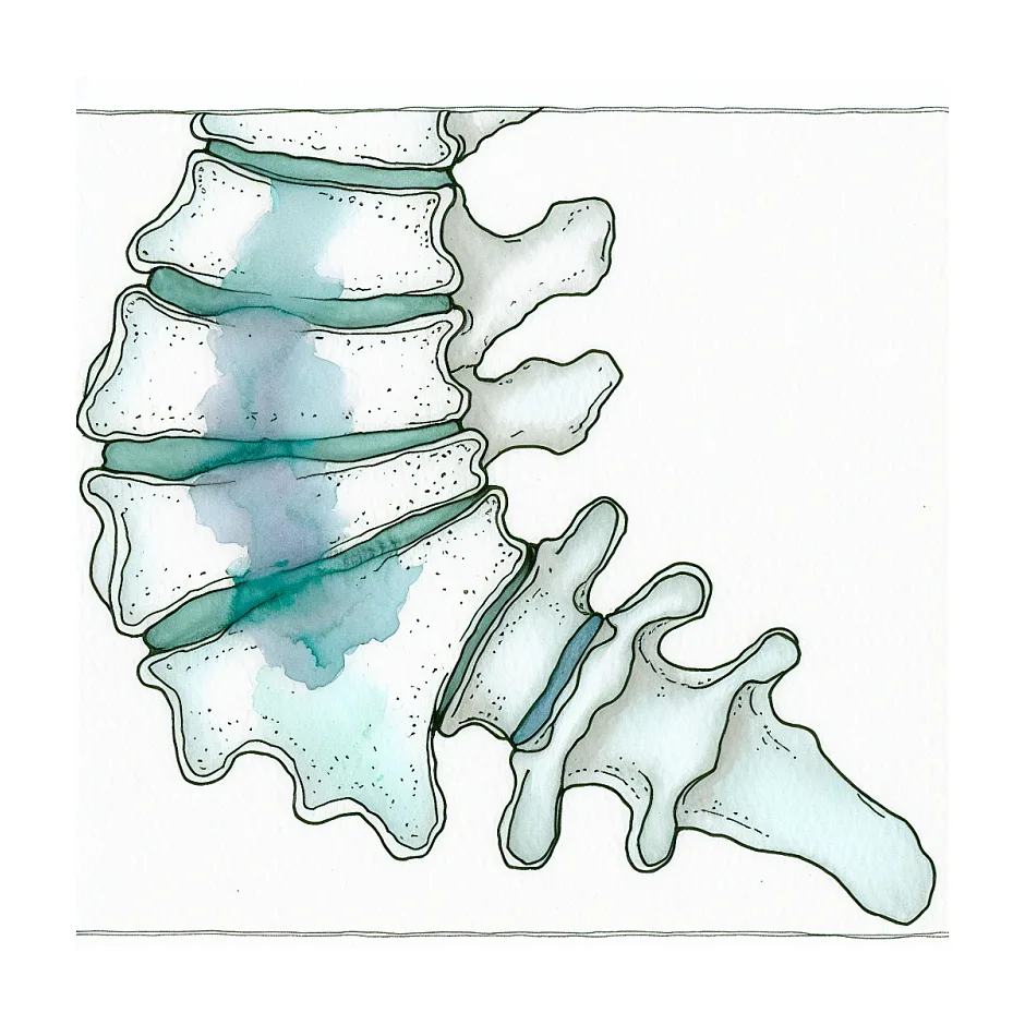 درمان دهیدراته شدن دیسک کمر چقدر ممکن است؟