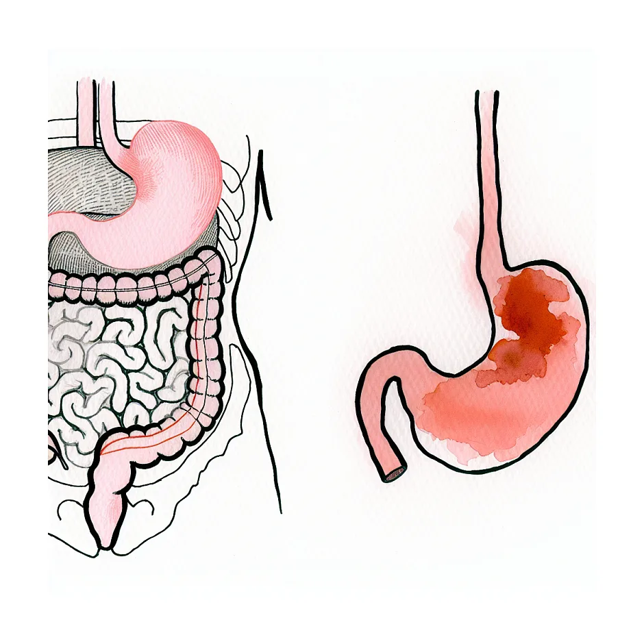 آیا کمخونی باعث کاهش اشتها می شود؟