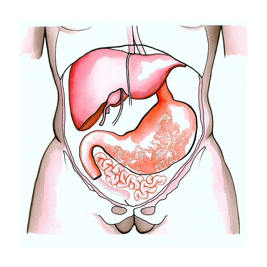 درد بعد از جراحی کیسه صفرا بعد از شش ماه