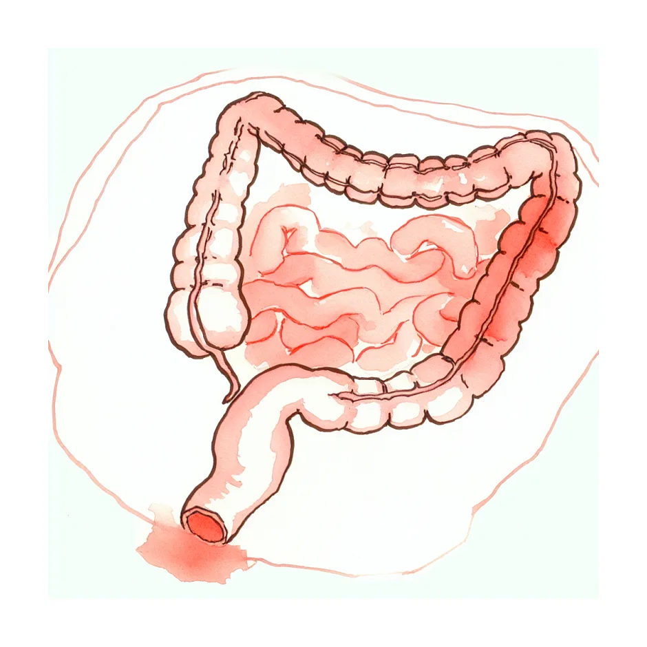 علت کش دار شدن مدفوع نوزاد ۵ ماهه