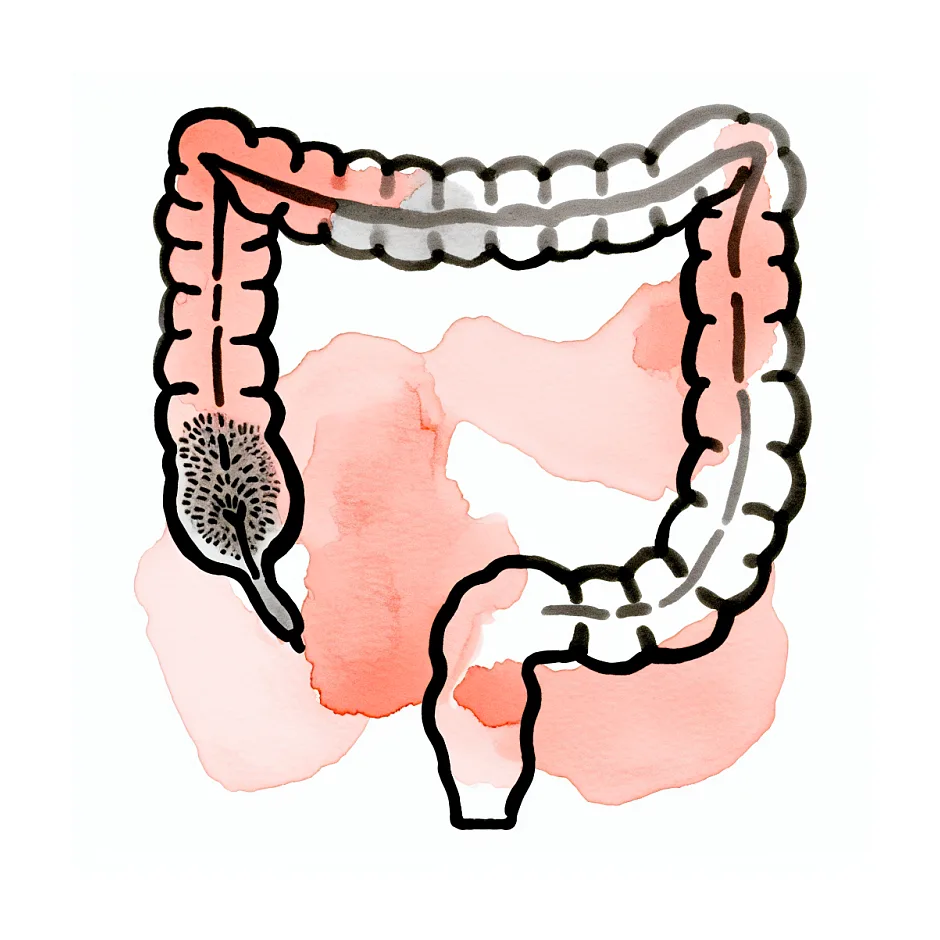 علت خلط در مدفوع کودک بعد از آنتی‌بیوتیک