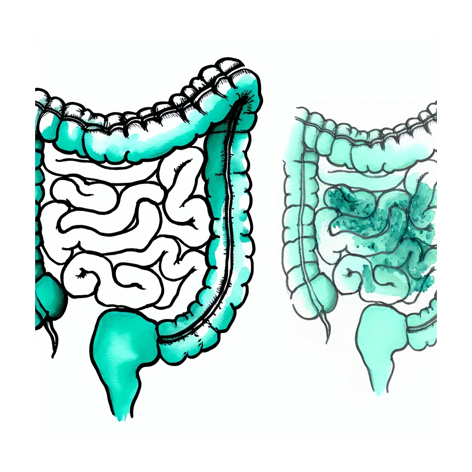 علت ورم روده، یبوست و لاغری شدید چیست؟