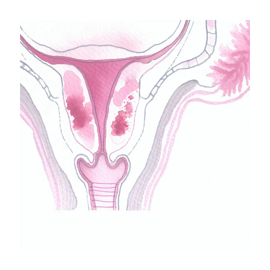 مصرف پماد تریامسینولون ان ان در بارداری