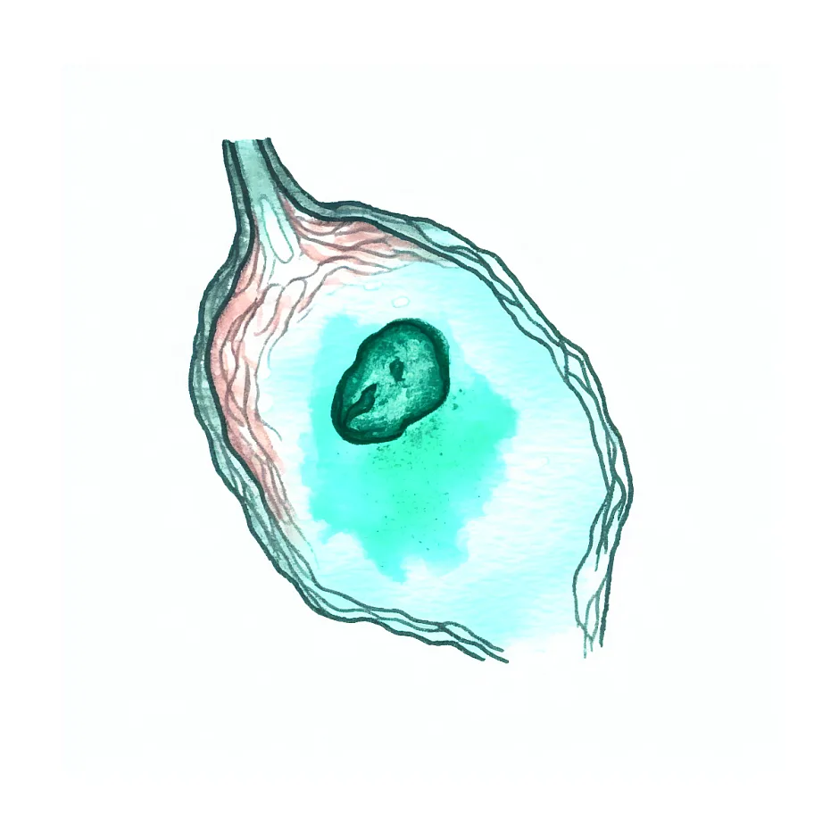 برداشتن غده چربی سر؛ نیاز به جراحی و تراشیدن موها